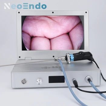 Портативна медицинска ендоскопска камера Full HD 